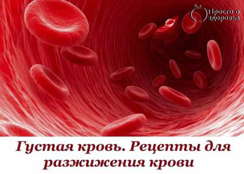 АСС, а также