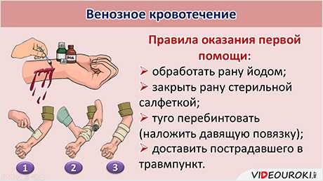 Написать дату и время наложения жгута на записке и прикрепить ее к жгуту