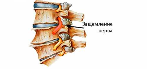 Врач назначит грудничку необходимые препараты, прикорм и питательные смеси, способствующие восстановлению баланса бактерий и микроорганизмов в пищеварительной системе, нарушенных дисбактериозом