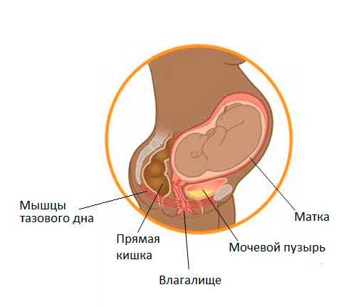 Недержание мочи после родов