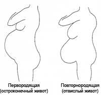 Форма живота при беременности